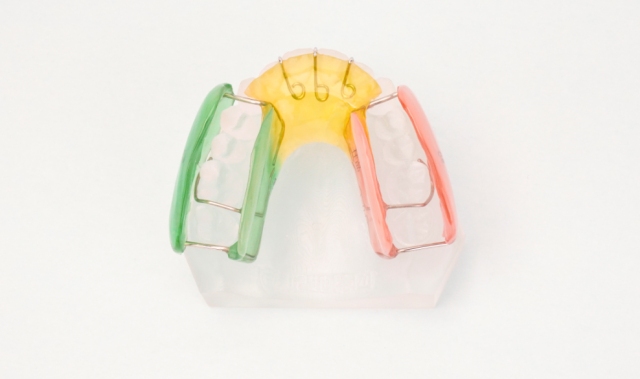 Bess磨牙升高矫治器