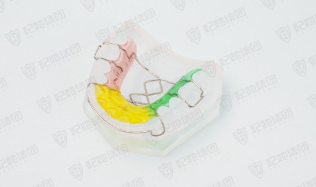 菱形簧扩弓矫治器