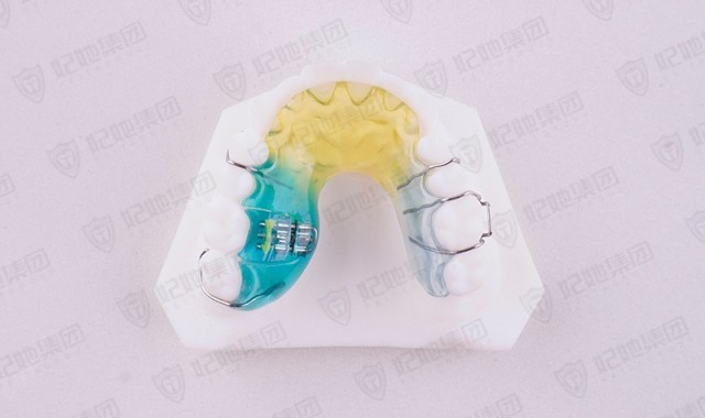 螺旋簧磨牙推进器