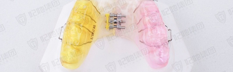 颌垫唇弓式螺旋簧横向扩弓矫治器