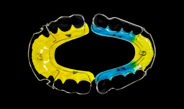 Wrap Around 环绕保持器(全口)