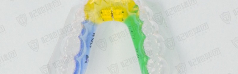 隐形横向扩弓矫治器（下颌）