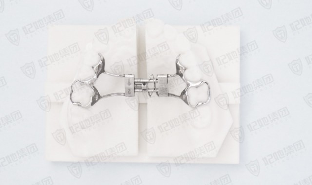 记忆簧支架式快速扩弓矫治器