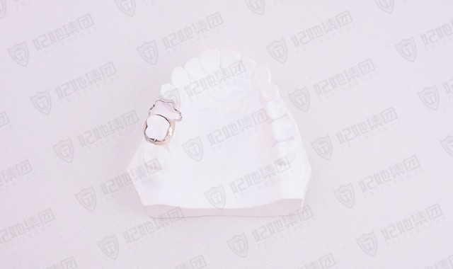 U曲型间隙恢复器(激光焊接)