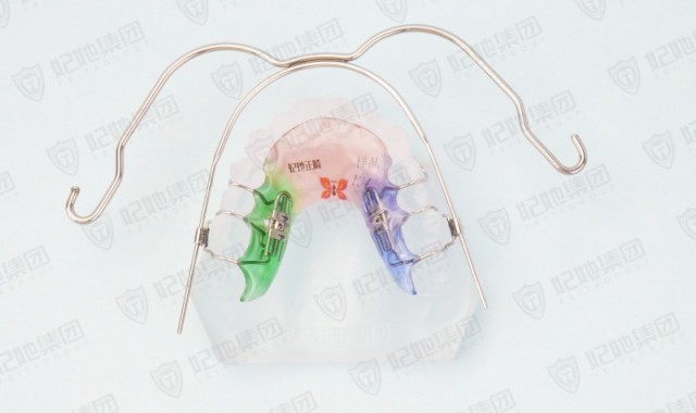 口外弓联合螺旋簧双侧磨牙后移矫治器