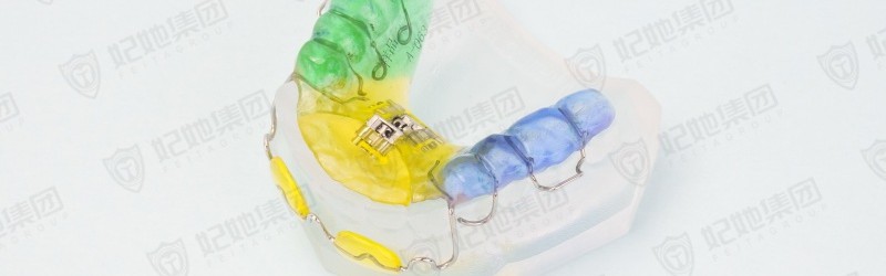 唇挡式三维扩弓矫治器