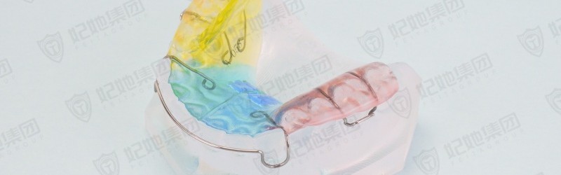 单翼螺旋簧横向扩弓矫治器