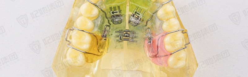 螺旋簧六方扩弓器