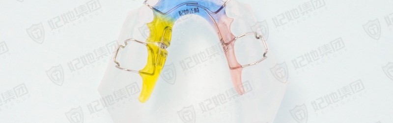 螺旋簧单侧磨牙后移矫治器