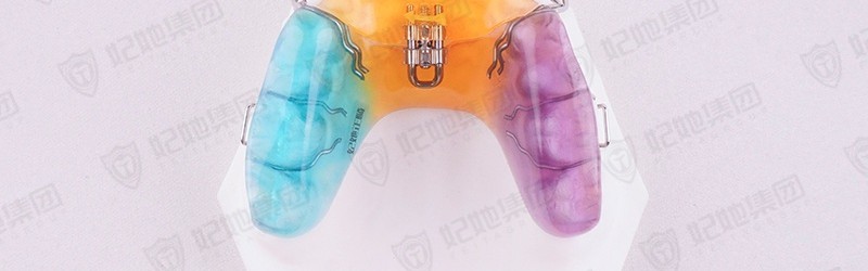 V型螺旋簧前方扩弓矫治器