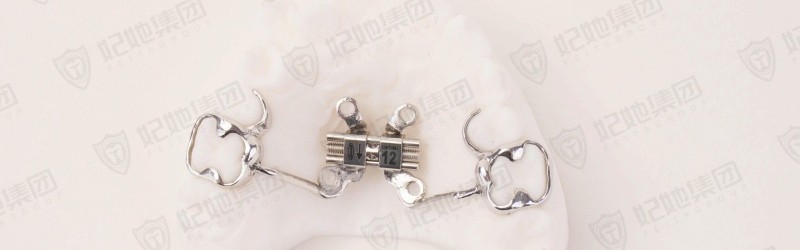 支抗钉骨性扩弓矫治器（铸造型MARPE)