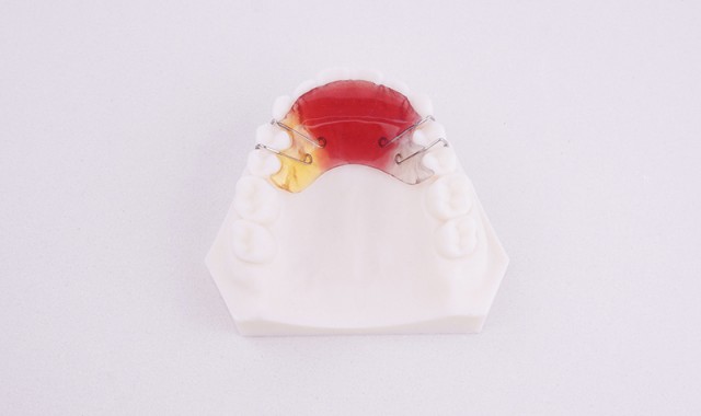 邻间钩式平导矫治器 