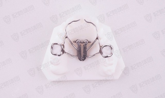 固定式扇形扩弓矫治器