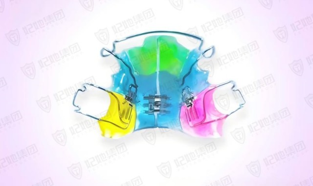 螺旋簧横向扩弓器联合双侧磨牙远移矫治器