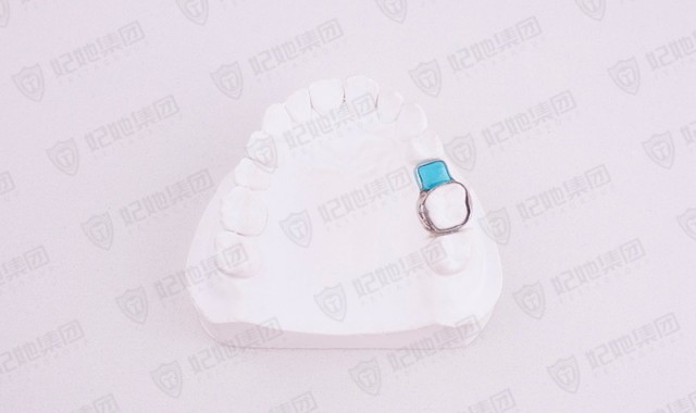 阻萌器 (激光焊接)