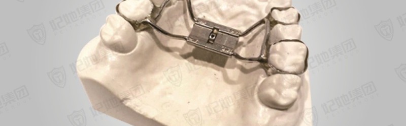 记忆型上颌支架式快速扩弓矫治器