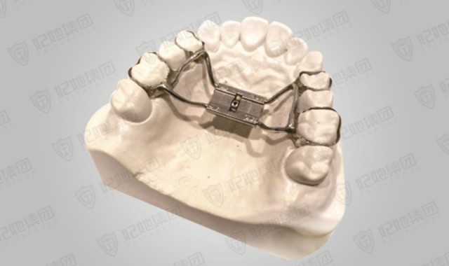 记忆型上颌支架式快速扩弓矫治器