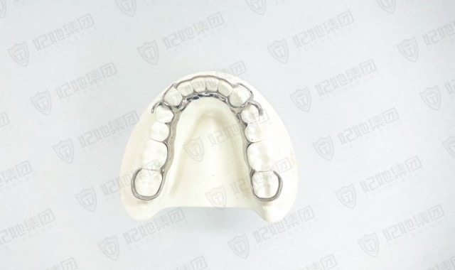 3D一体成型保持器（下）