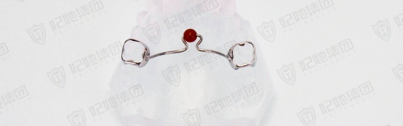 固定腭珠式舌诱导器(激光焊接)