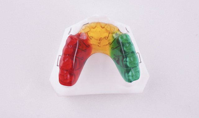 前牵式舌簧颌垫矫治器