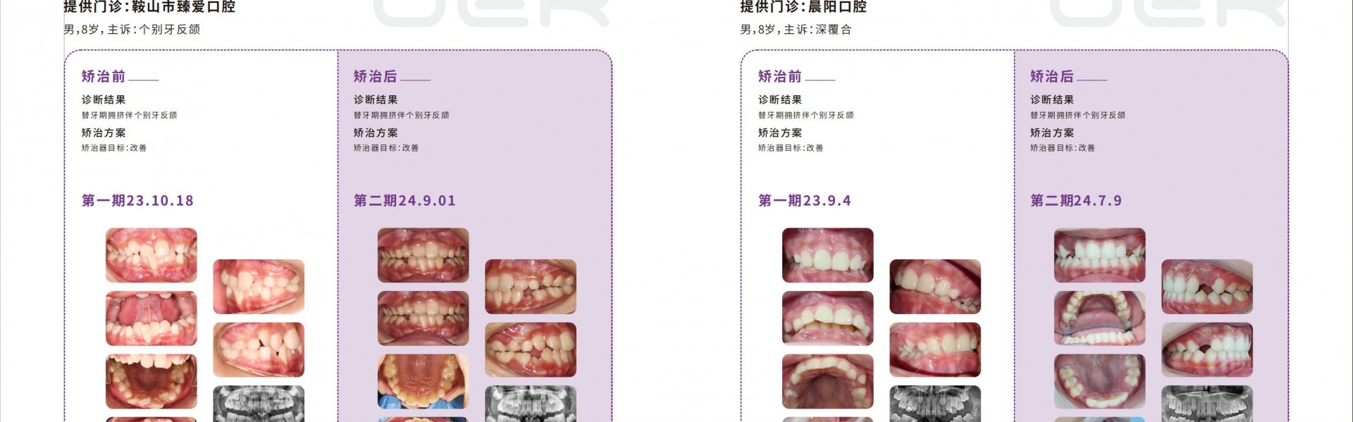 病例介绍