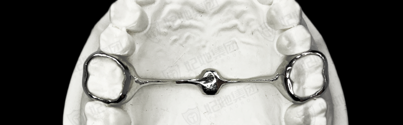 TPA横腭杆（3D一体成型）