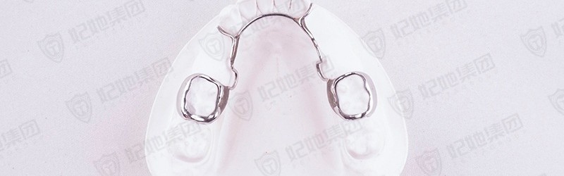 辅丝式舌弓缺隙保持器(激光焊接)  