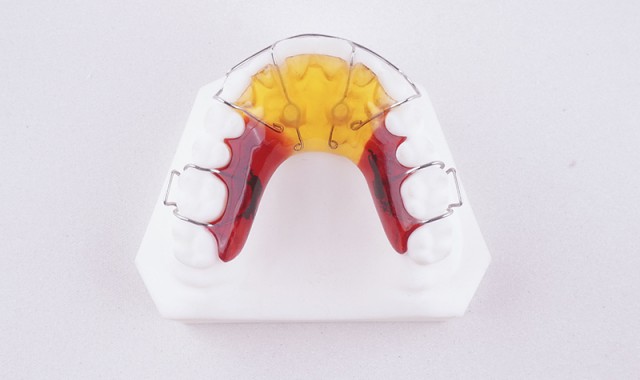 唇弓指簧矫治器 