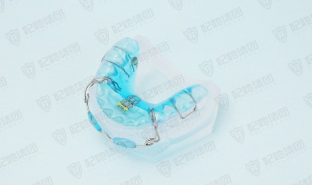 唇挡前牵式V字型前方扩弓矫治器