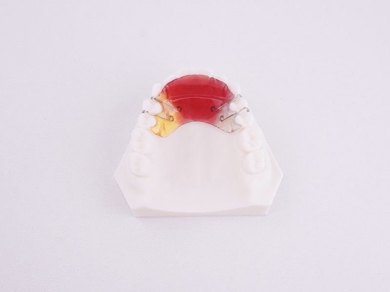 051-2-邻间钩式平导矫治器 .jpg