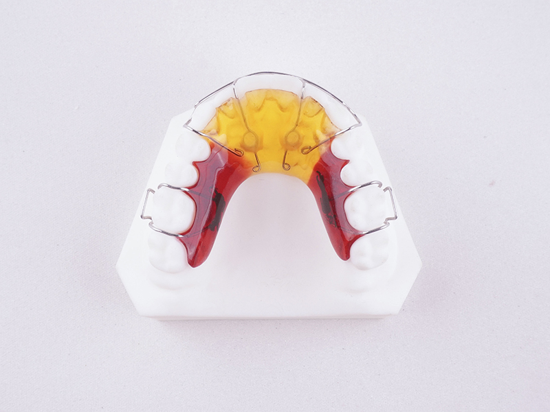 054-唇弓指簧矫治器 .jpg